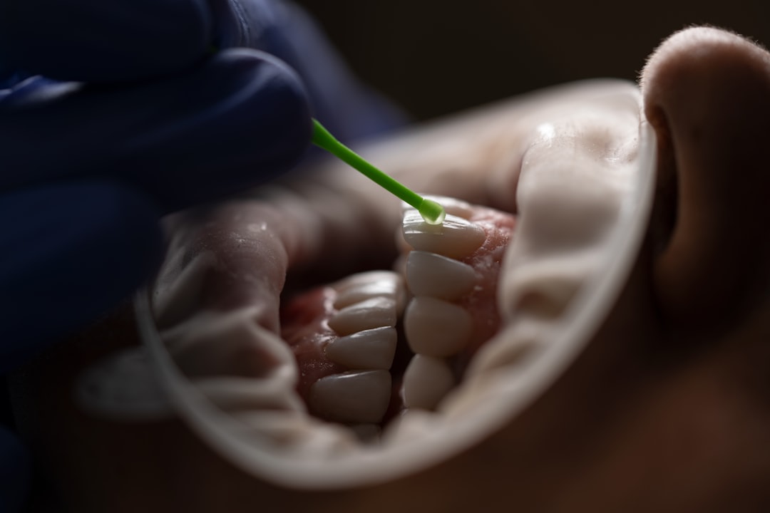 Photo teeth
